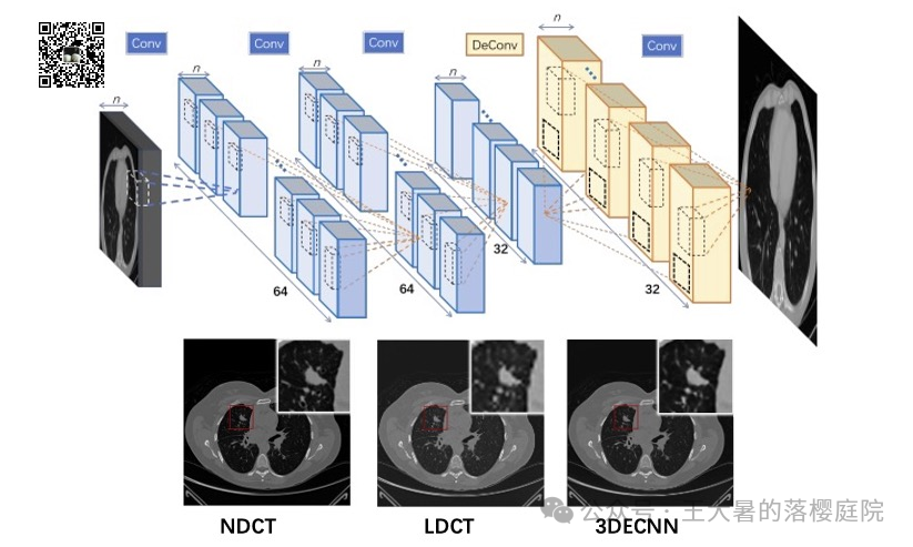 #108 CT重建的3D深度学习技术——深度学习图像重建算法分类2 #108 CT重建的3D深度学习技术——深度学习图像重建算法分类2